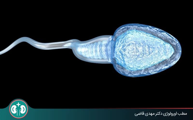 اسپرم بعد از وازکتومی چه می‌شود؟