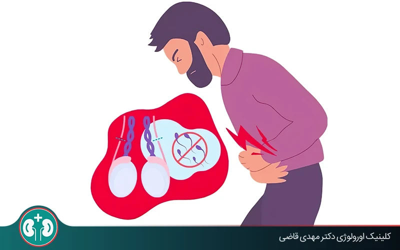 بررسی کامل عوارض وازکتومی + مراقبت‌های بعد از عمل و راه‌حل‌ها