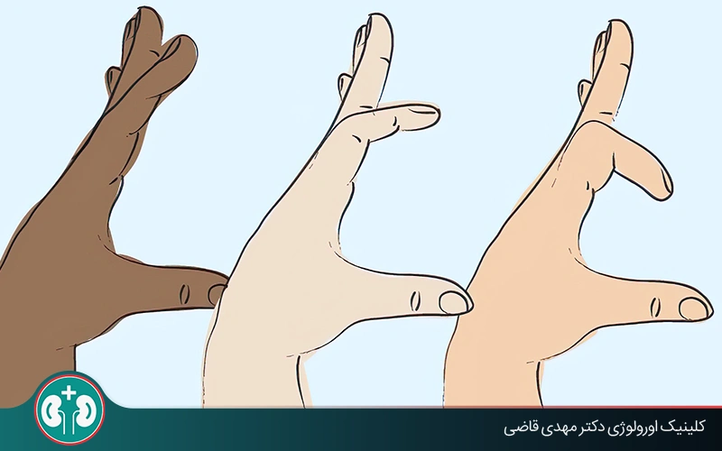 اندازه استاندارد آلت تناسلی چقدر است؟ + روش دقیق اندازهگیری