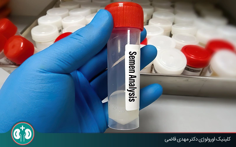 آزمایش اسپرم بعد از وازکتومی؛ روش انجام، تفسیر نتایج و زمان مناسب
