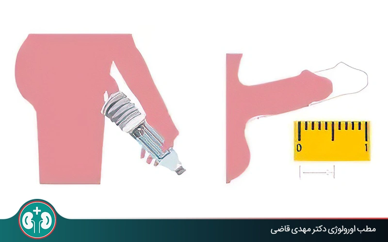 روشهای طبیعی و خانگی بزرگ کردن آلت تناسلی؛ بررسی علمی + هشدارهای پزشکی