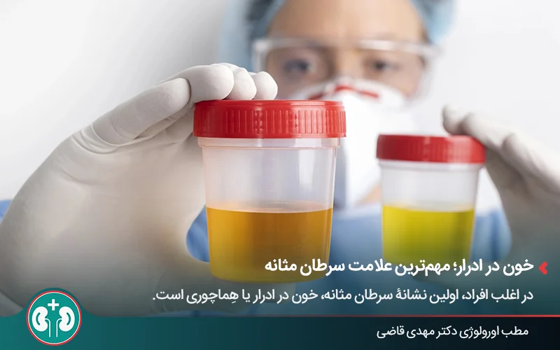 تصویر مردی که ۲ نمونۀ ادرار با رنگ‌های مختلف در دست دارد
