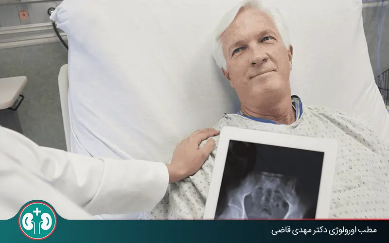 طول عمر بیماران سرطان مثانه چقدر است؟ نقش عوامل فردی و پزشکی