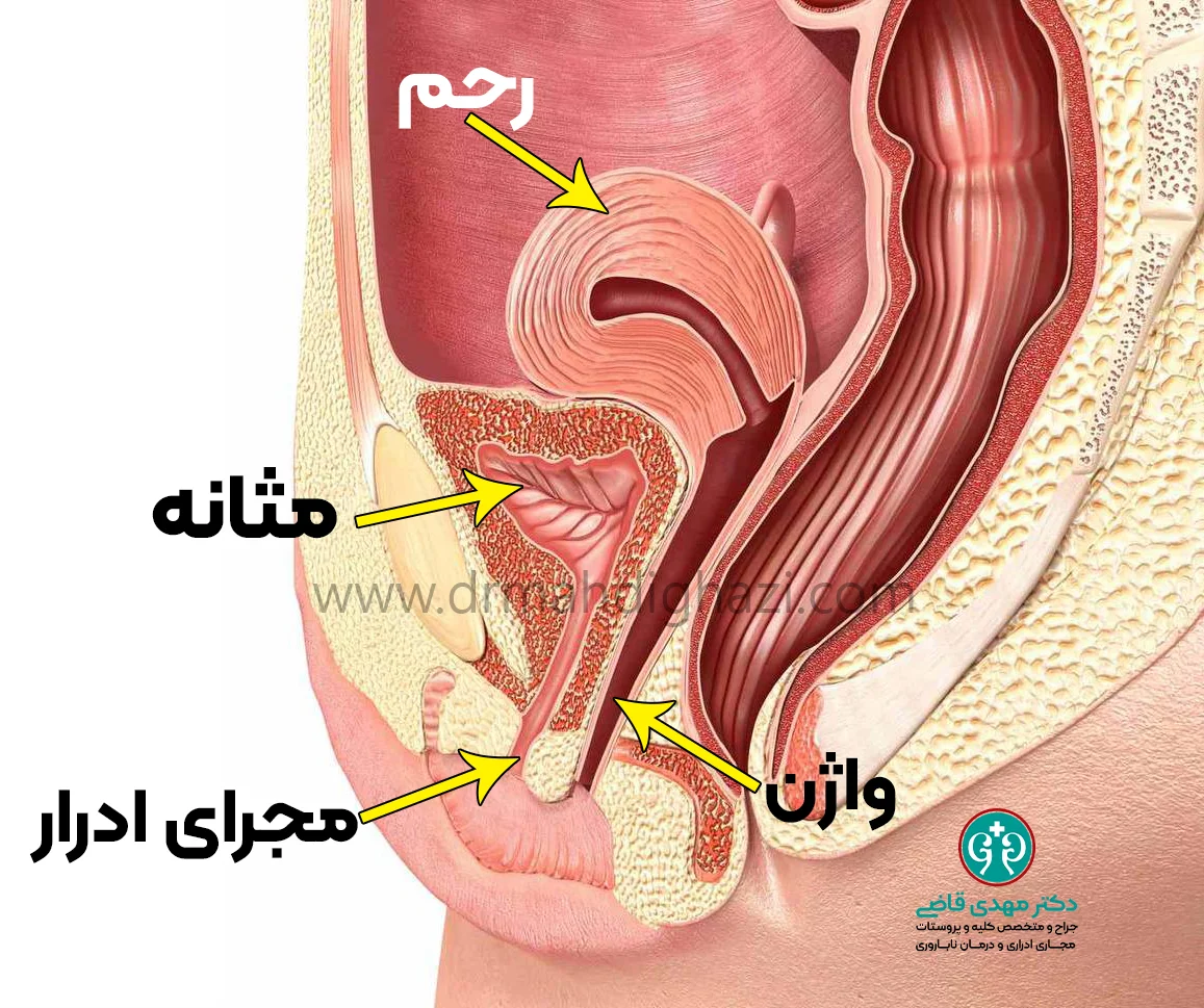 دکتر قاضی-• کارونکل مجرای ادرار-• علائم توده‌های خوش خیم مجرای ادرار در دختران