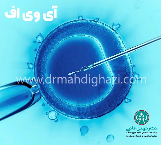 دکتر قاضی- آی وی اف بهترین روش‌های درمان ناباروری