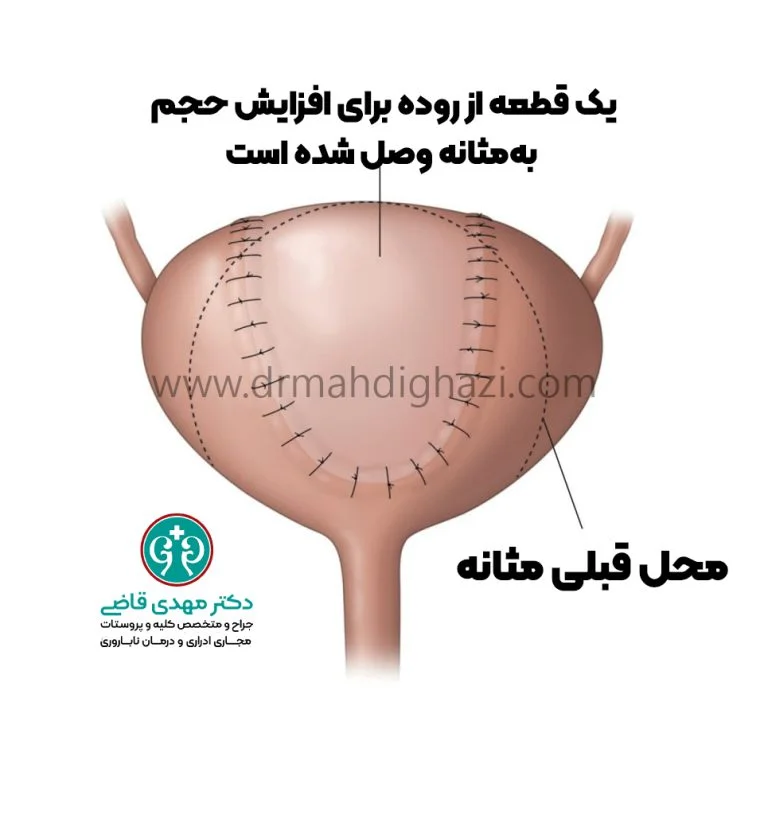 آلت تصویر شاخص