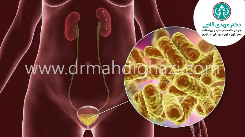 دکتر قاضی-سیستیت چیست؟ تشخیص و درمان
