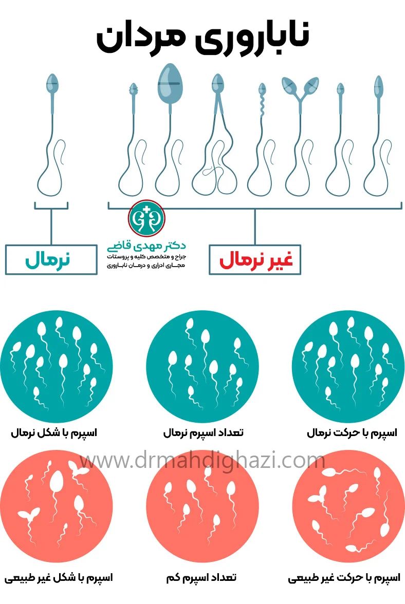 دکتر قاضی- ناباروری مردان